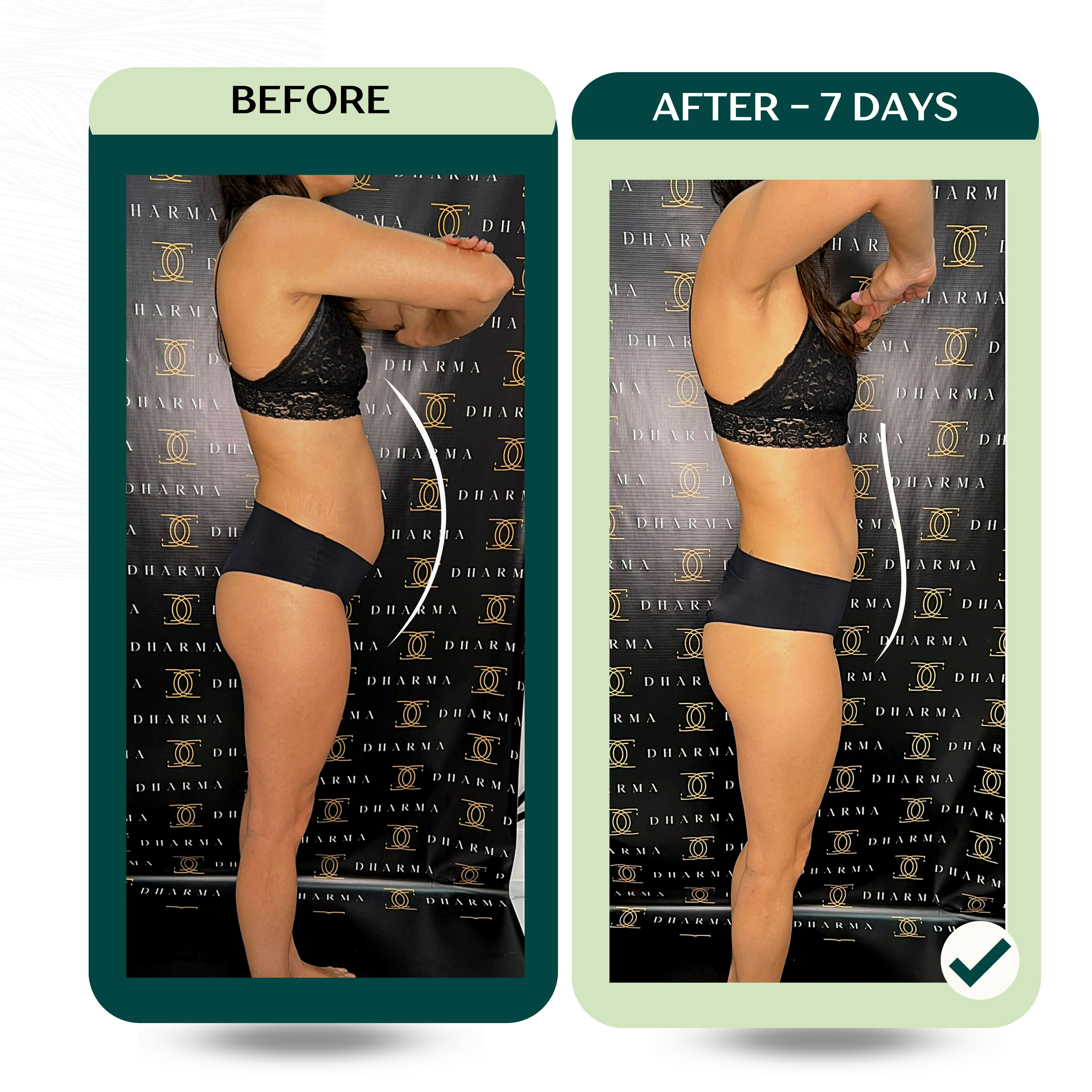 Original Detox Tea package front label showing herbal detox blend for bloating relief and digestion support